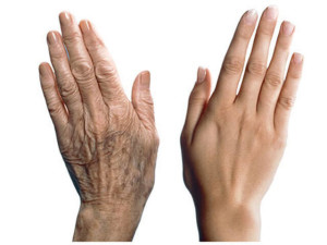 Старение рук